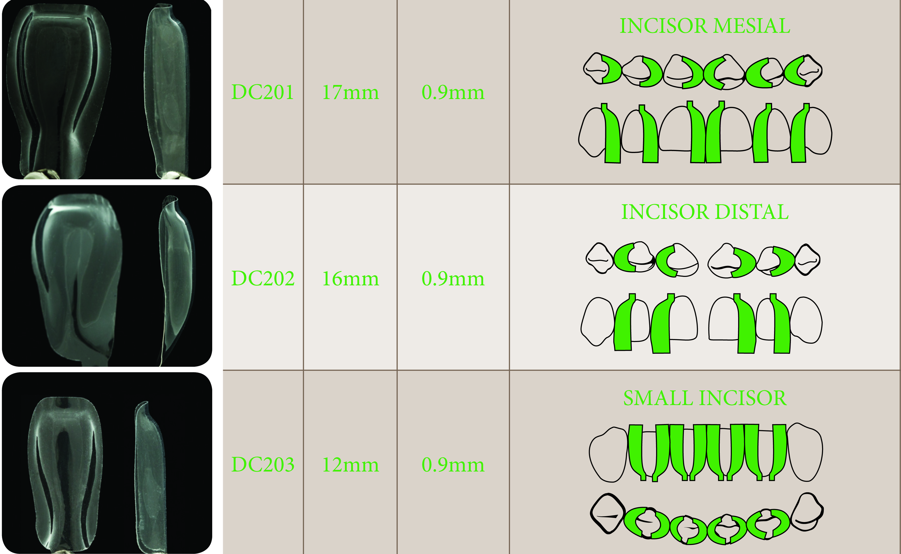 Closing the Gap in Direct Dentistry Treating Black Triangles Optident